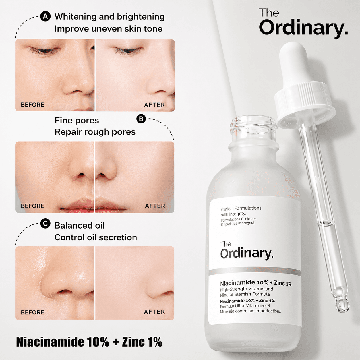 Niacinamide 10% + Zinc 1%-30 M.L (Double Layer Labelling)
The Ordinary quantity thumbnail 4